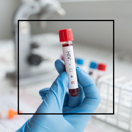 You are currently viewing How to deal with an HIV/AIDS diagnosis as a newcomer to Canada